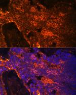 Spectrin alpha-1 Antibody in Immunocytochemistry (ICC/IF)