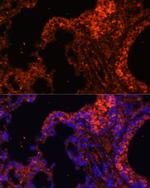 Spectrin alpha-1 Antibody in Immunocytochemistry (ICC/IF)