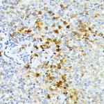 Spectrin alpha-1 Antibody in Immunohistochemistry (Paraffin) (IHC (P))