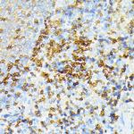 Spectrin alpha-1 Antibody in Immunohistochemistry (Paraffin) (IHC (P))