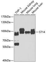 ST14 Antibody in Western Blot (WB)