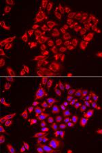 ST3GAL3 Antibody in Immunocytochemistry (ICC/IF)