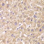 ST3GAL3 Antibody in Immunohistochemistry (Paraffin) (IHC (P))