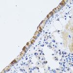 ST3GAL3 Antibody in Immunohistochemistry (Paraffin) (IHC (P))