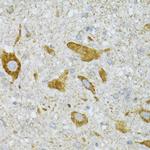 ST3GAL3 Antibody in Immunohistochemistry (Paraffin) (IHC (P))