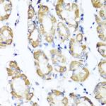 ST6GAL1 Antibody in Immunohistochemistry (Paraffin) (IHC (P))