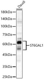 ST6GAL1 Antibody in Western Blot (WB)