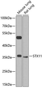 STX11 Antibody in Western Blot (WB)