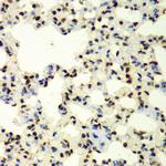 SUMO2 Antibody in Immunohistochemistry (Paraffin) (IHC (P))