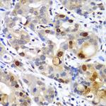 SUMO2 Antibody in Immunohistochemistry (Paraffin) (IHC (P))