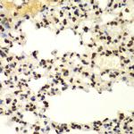 SUMO2 Antibody in Immunohistochemistry (Paraffin) (IHC (P))