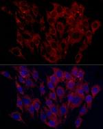 SURF4 Antibody in Immunocytochemistry (ICC/IF)