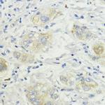 SURF4 Antibody in Immunohistochemistry (Paraffin) (IHC (P))