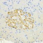 SURF4 Antibody in Immunohistochemistry (Paraffin) (IHC (P))