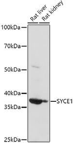 SYCE1 Antibody in Western Blot (WB)