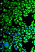 TBPL1 Antibody in Immunocytochemistry (ICC/IF)