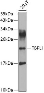 TBPL1 Antibody in Western Blot (WB)