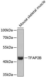 TFAP2B Antibody in Western Blot (WB)