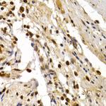 DP1 Antibody in Immunohistochemistry (Paraffin) (IHC (P))