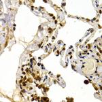 DP1 Antibody in Immunohistochemistry (Paraffin) (IHC (P))