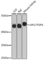 DP1 Antibody in Western Blot (WB)