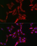 TFRC Antibody in Immunocytochemistry (ICC/IF)