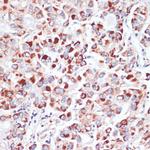 TFRC Antibody in Immunohistochemistry (Paraffin) (IHC (P))