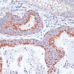 TFRC Antibody in Immunohistochemistry (Paraffin) (IHC (P))