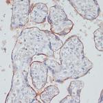 TFRC Antibody in Immunohistochemistry (Paraffin) (IHC (P))