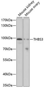 Thrombospondin 3 Antibody in Western Blot (WB)