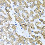 TOB2 Antibody in Immunohistochemistry (Paraffin) (IHC (P))