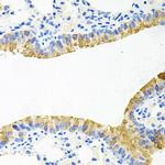 TOB2 Antibody in Immunohistochemistry (Paraffin) (IHC (P))