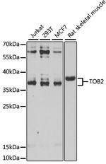 TOB2 Antibody in Western Blot (WB)