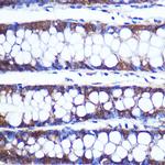 TOP1MT Antibody in Immunohistochemistry (Paraffin) (IHC (P))