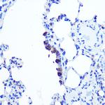 TOP1MT Antibody in Immunohistochemistry (Paraffin) (IHC (P))