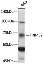 TRIM32 Antibody in Western Blot (WB)