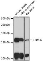 TRIM37 Antibody in Western Blot (WB)