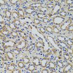 TRMT2A Antibody in Immunohistochemistry (Paraffin) (IHC (P))