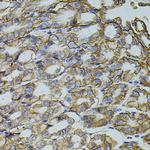 TRMT2A Antibody in Immunohistochemistry (Paraffin) (IHC (P))