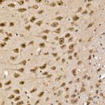 UCHL5 Antibody in Immunohistochemistry (Paraffin) (IHC (P))