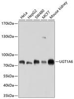 UGT1A6 Antibody in Western Blot (WB)