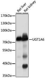 UGT1A6 Antibody in Western Blot (WB)