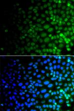 ULK4 Antibody in Immunocytochemistry (ICC/IF)