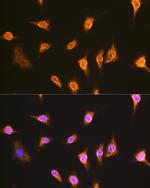 Alix Antibody in Immunocytochemistry (ICC/IF)