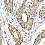 VPS4A Antibody in Immunohistochemistry (Paraffin) (IHC (P))