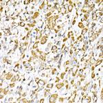 VPS4A Antibody in Immunohistochemistry (Paraffin) (IHC (P))