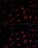 WDR18 Antibody in Immunocytochemistry (ICC/IF)