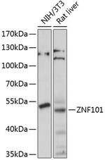 ZNF101 Antibody in Western Blot (WB)