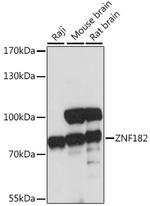 ZNF182 Antibody in Western Blot (WB)