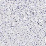 Cytokeratin 17 Antibody in Immunohistochemistry (Paraffin) (IHC (P))